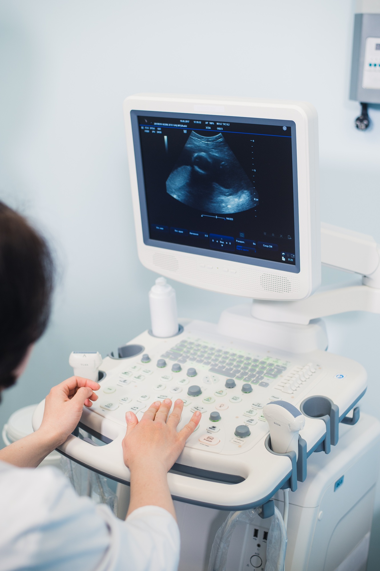 Skillful sonographer using ultrasound machine at work