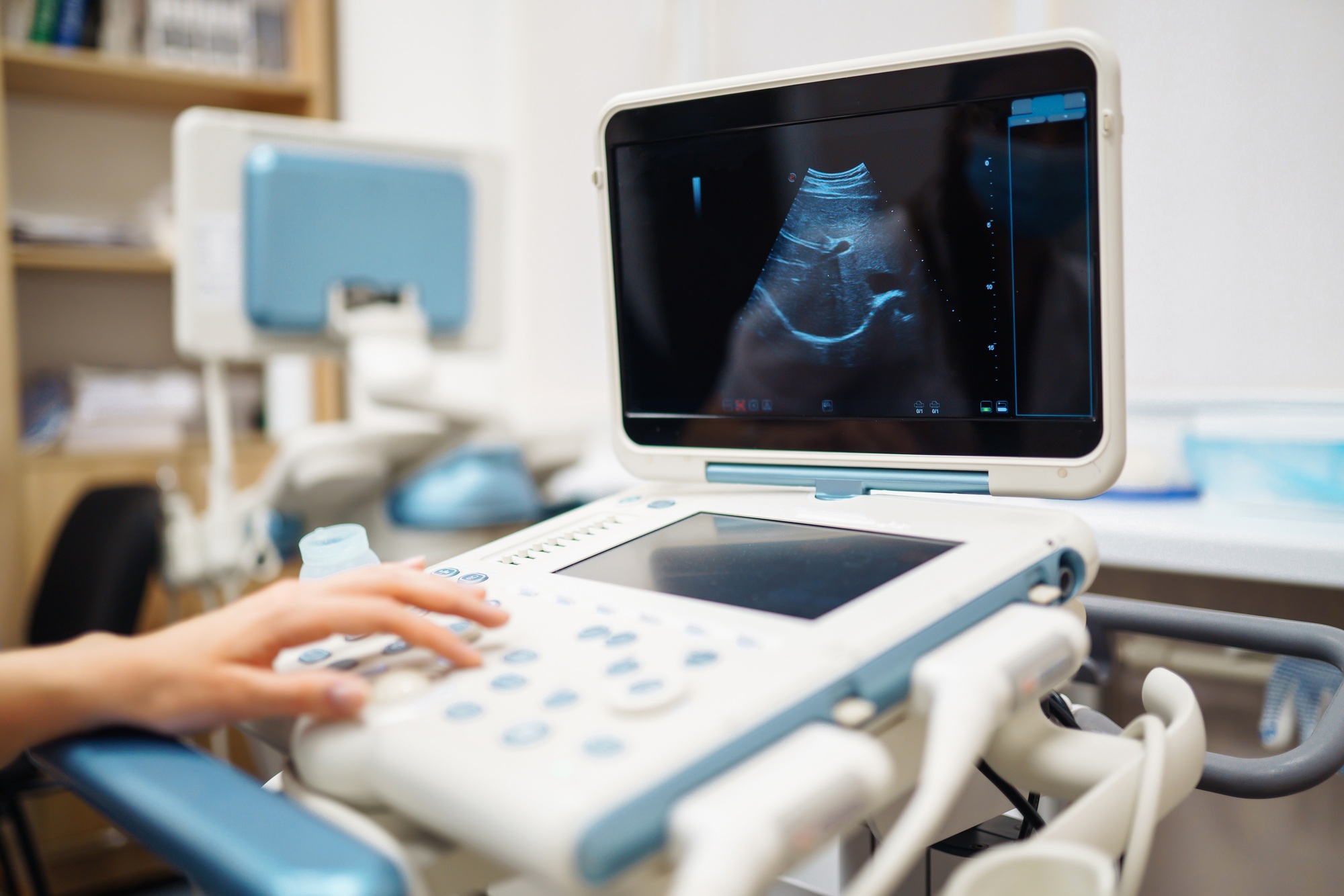 Ultrasound machine in the doctor's office in the clinic Diagnostics. Sonography. Pregnancy.